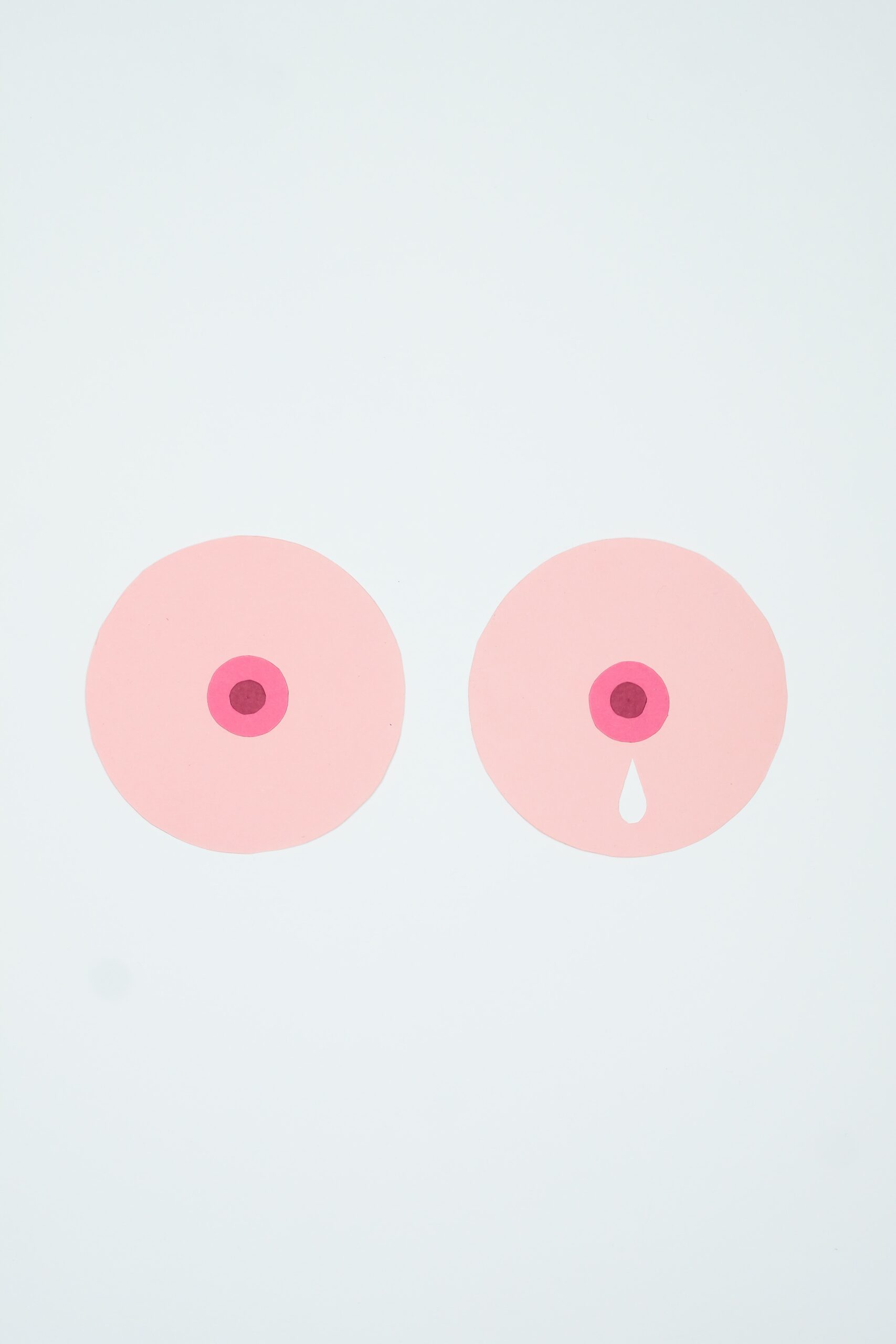 Có nhiều yếu tố góp phần vào loại nhiễm trùng này